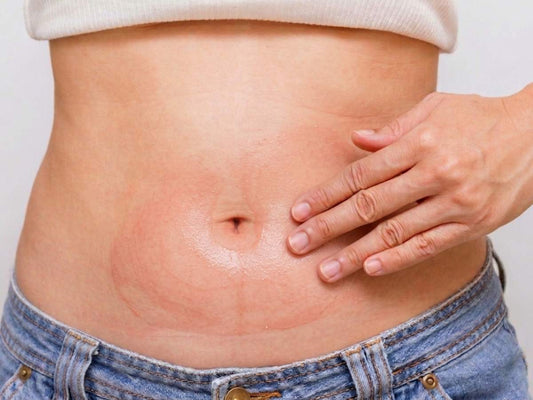 Mujer usando pack reductor Criogel + Termogel BEL